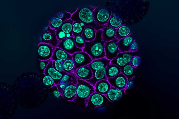 pancreatic cancer cells